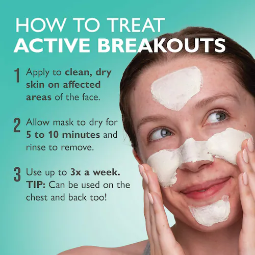 Even Clearer™ Therapeutic Sulfur Acne Mask for Pores and Oil Control 6